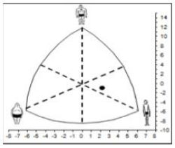 Figura 2. Somatocarta que representa el punto de los tres componentes (ENDO –  MESO - ECTO)