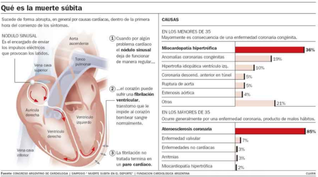 Muerte súbita, un asunto más que vital